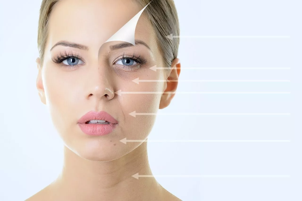 Botox Treatment- The Benefits and Risks Involved